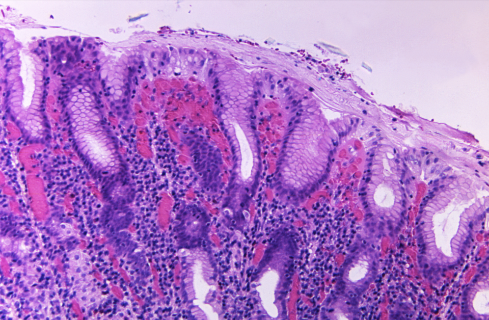 File:Gastric Cells.png