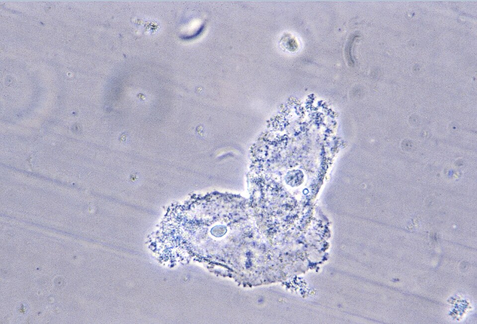 File:Clue cells - CDC PHIL 3720.jpg