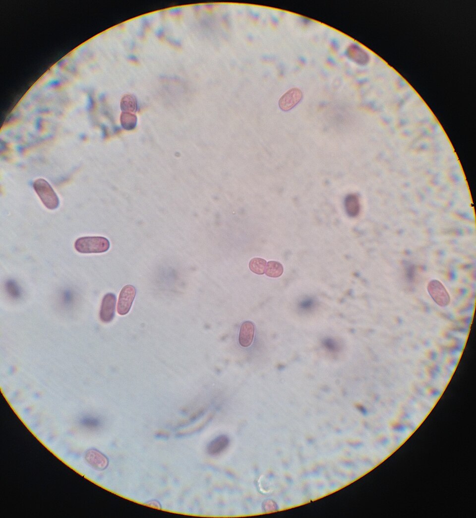 File:Chromatium Okenii al microscopio.jpg