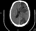 Thumbnail for version as of 03:48, 17 April 2025