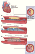Thumbnail for version as of 08:20, 22 July 2006