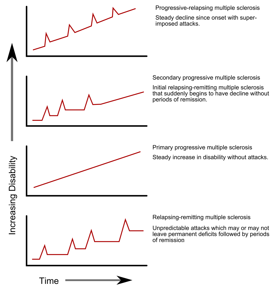 File:Ms progression types.svg