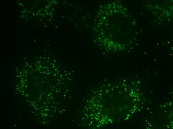 Peroxisome in rat neonatal cardiomyocyte staining The SelectFX Alexa Fluor 488 Peroxisome Labeling Kit directed against peroxisomal membrane protein 70 (PMP 70)
