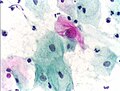 Thumbnail for version as of 08:19, 7 September 2006