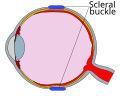 Thumbnail for version as of 20:49, 28 June 2009