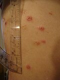 Thumbnail for version as of 13:59, 11 November 2007
