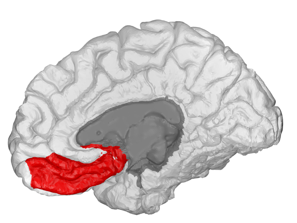 File:Medial Orbitofrontal - DK ATLAS.png