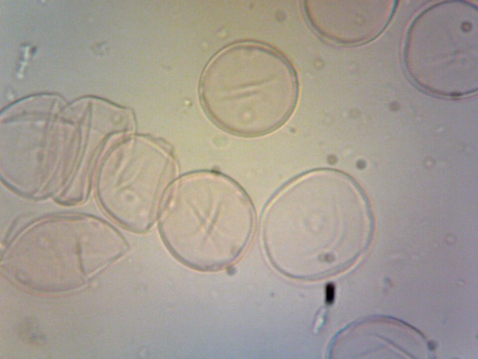 File:Urtica dioica (Stinging Nettle) pollen.tif