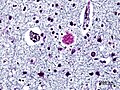 Bowdian stain 2