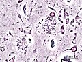Silver stain 2
