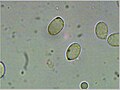 Amanita muscaria spores