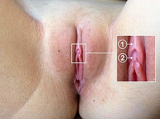 Human clitoris. Pubic hair has been deliberately removed to show anatomical detail.