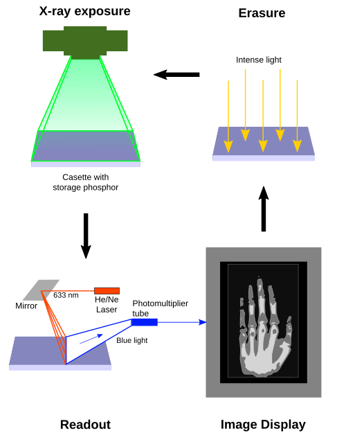 File:Computed Radiography Process.svg