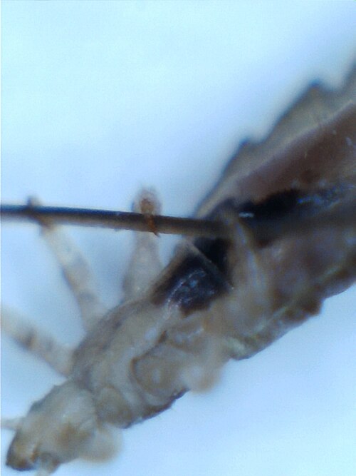 File:Head louse on human hair.jpg