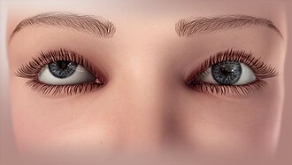 The visual axis of one eye is higher than the fellow fixating eye.