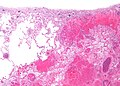 Thumbnail for version as of 17:17, 12 June 2010