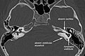 Thumbnail for version as of 08:38, 10 March 2017