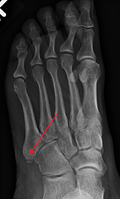 Thumbnail for version as of 06:03, 28 May 2016