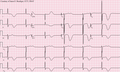 Thumbnail for version as of 23:46, 6 June 2012