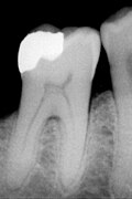 Thumbnail for version as of 00:22, 8 January 2005
