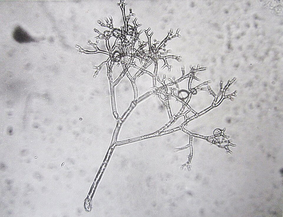 File:Conidophores of Peronospora tabacina.jpg