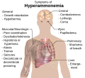 Thumbnail for version as of 05:30, 4 March 2012