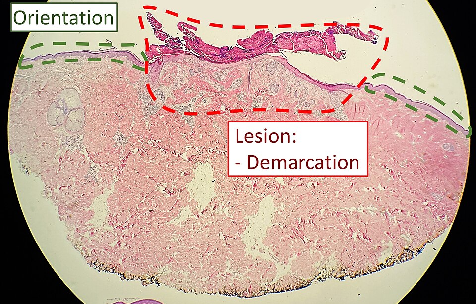 File:Systematic microscopy 2 - Orientation.jpg