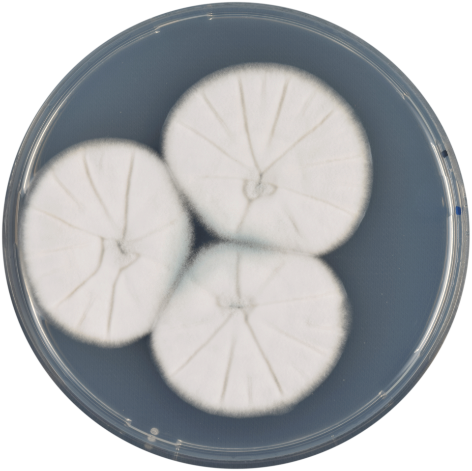 File:Aspergillus lentulus cya.png
