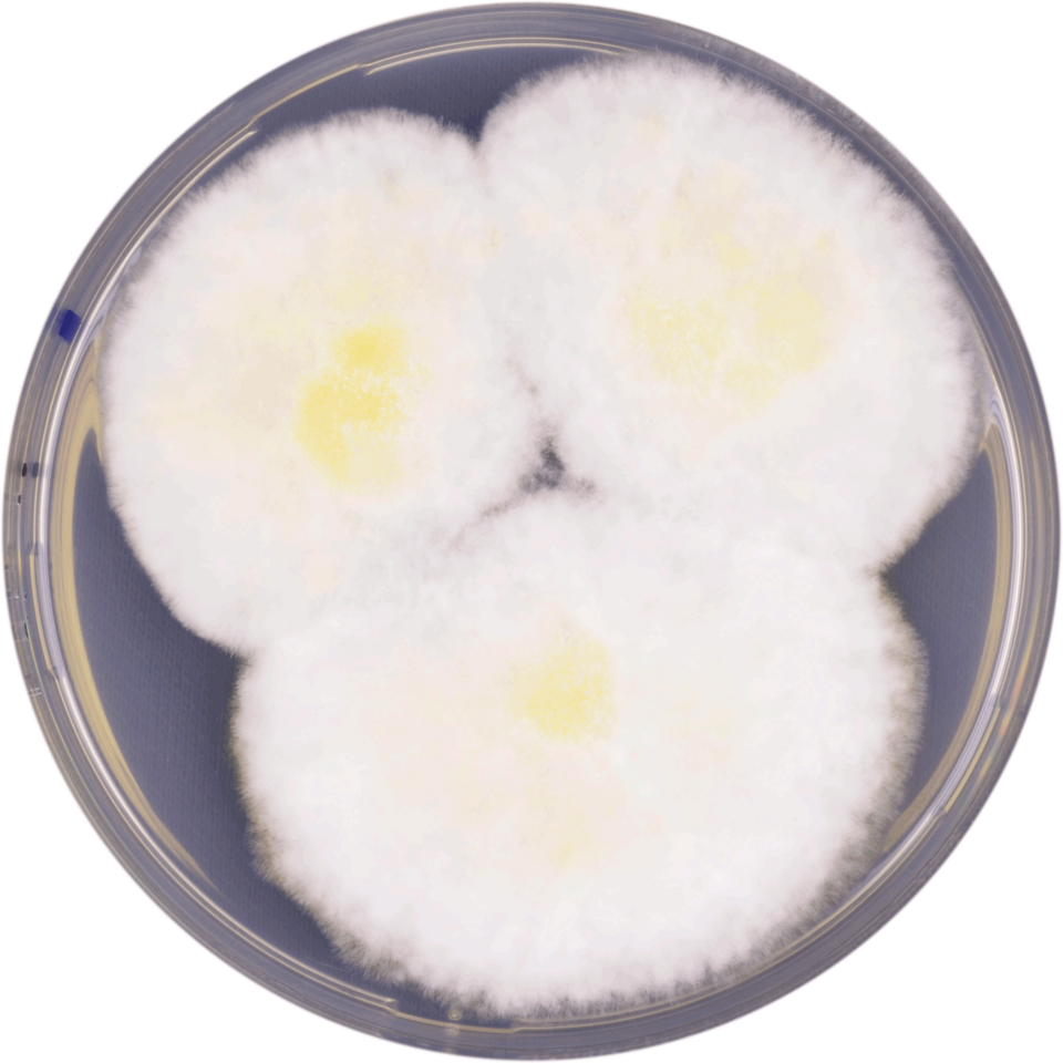 File:Aspergillus albertensis cya.png