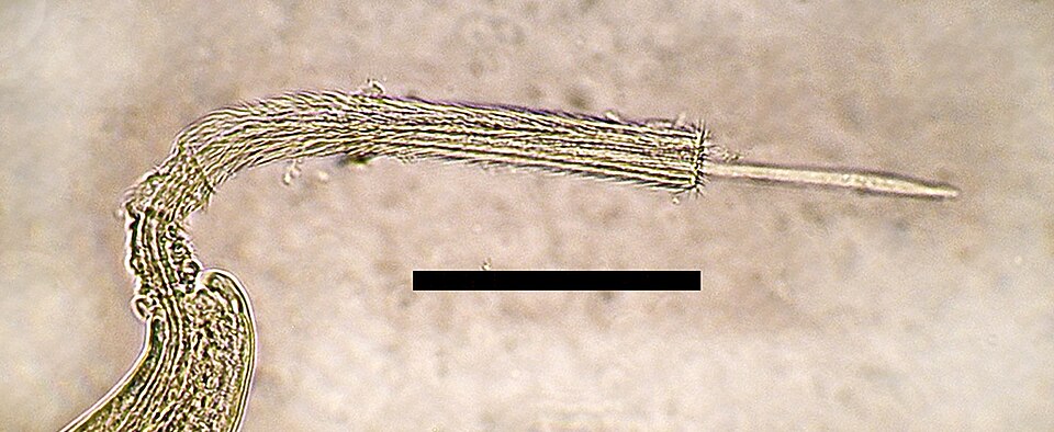 File:Eucoleus aerophilus male spicule.jpg