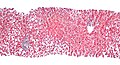 Periportal hepatosteatosis (low magnification).