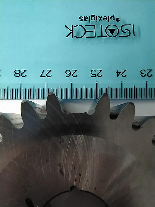 File:Tooth root fatigue fracture.jpg