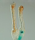 The polycomb gene FIE is expressed (blue) in unfertilised egg cells of the moss P. patens (right) and expression ceases after fertilisation in the developing diploid sporophyte (left). In situ GUS staining of two female sex organs (archegonia) of a transgenic plant expressing a translational fusion of FIE-uidA under control of the native FIE promoter.