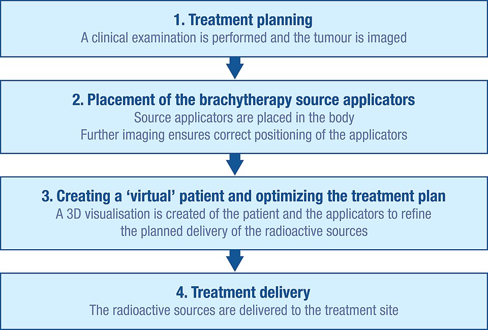 File:Brachytherapy procedure flow.jpg
