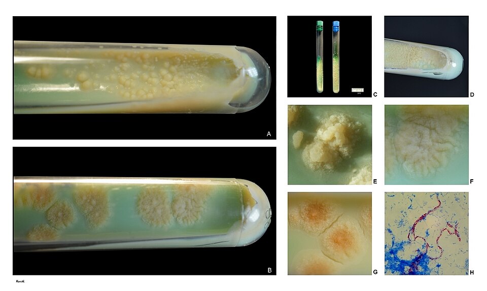 File:M.tuberculosis.jpg