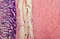 Tissue layers (mucosa, submucosa and muscularis)
