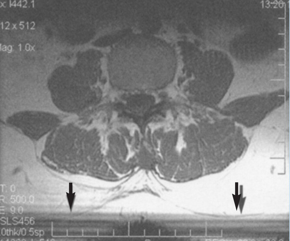 File:MRI with slice-to-slice interference.jpg