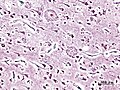 Thumbnail for version as of 12:52, 4 February 2006
