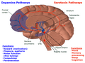 Thumbnail for version as of 23:44, 21 November 2015