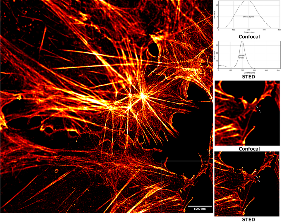 File:STED Confocal Comparison 50nm HWFM.png