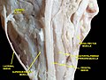 Thumbnail for version as of 15:41, 4 April 2013