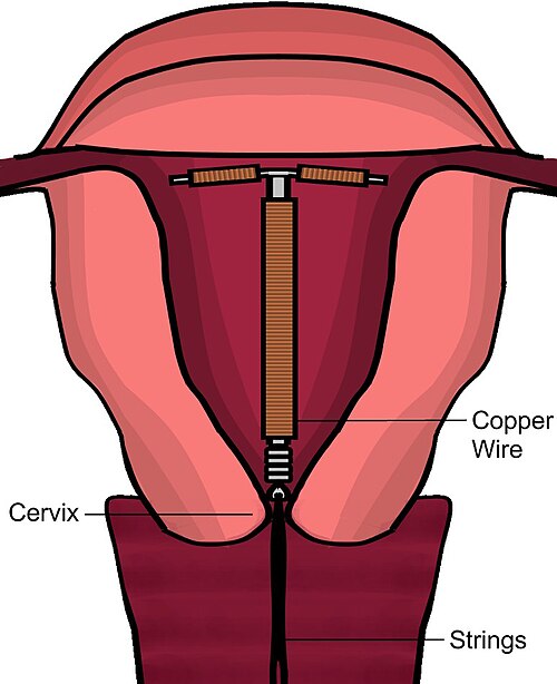 File:Iuddiagram.jpg