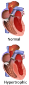 Thumbnail for version as of 23:19, 27 September 2015