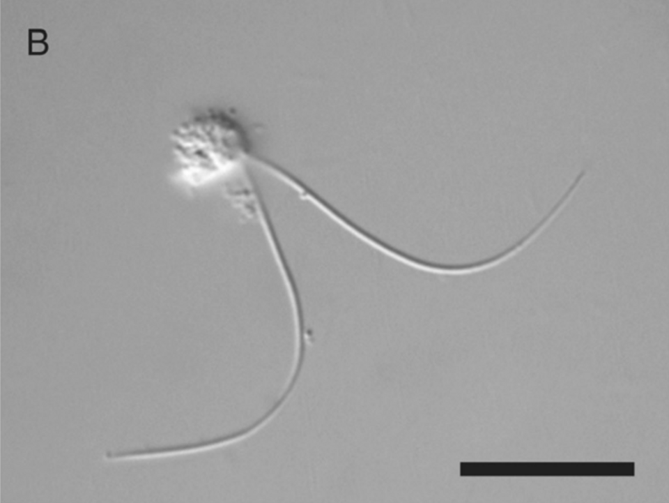 File:Palpitomonas bilix 2010 fig1b.png