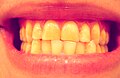 Thumbnail for version as of 09:33, 12 May 2016
