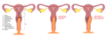 Thumbnail for version as of 19:48, 15 June 2022