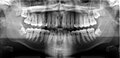 Thumbnail for version as of 13:51, 3 March 2013