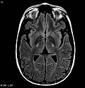 Thumbnail for version as of 21:38, 29 March 2010