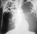 Thumbnail for version as of 05:06, 21 March 2011