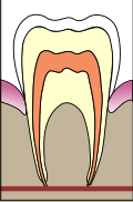 Thumbnail for version as of 23:58, 15 February 2007